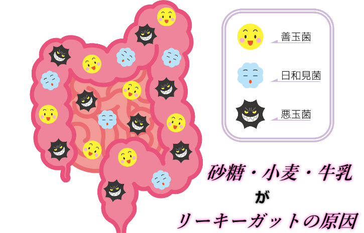 砂糖、小麦で腸がおかしくなる